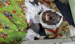 Korban terbakar