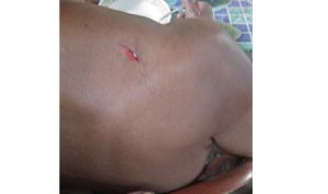 waci